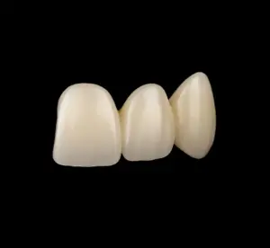 Three white front teeth veneers aligned in a row on a black background.
